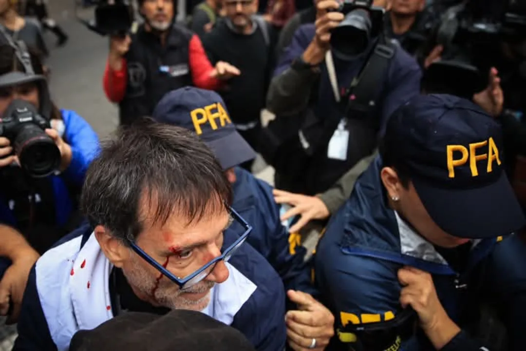 REPRESIÓN EN CONGRESO: LA POLICÍA HIRIÓ AL PADRE PACO EN LA MARCHA DE JUBILADOS post thumbnail image