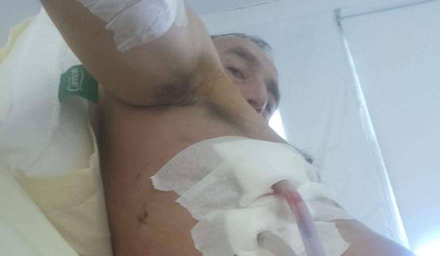 SAN CLEMENTE DEL TUYÚ: UN PLOMERO FUE APUÑALADO Y PERMANECE INTERNADO TRAS UN VIOLENTO ATAQUE